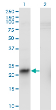 Western Blot analysis of ITGB3BP expression in transfected 293T cell line by ITGB3BP monoclonal antibody (M01), clone 3F6.Lane 1: ITGB3BP transfected lysate(20.2 KDa).Lane 2: Non-transfected lysate.