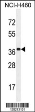 ZC3H15 Antibody (C-term) (Cat. #AP10865b) western blot analysis in NCI-H460 cell line lysates (35ug/lane).This demonstrates the ZC3H15 antibody detected the ZC3H15 protein (arrow).