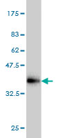 Antibody Reactive Against Recombinant Protein.Western Blot detection against Immunogen (35.86 KDa) . 