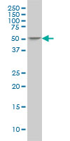 ING3 monoclonal antibody (M02), clone 2C4 Western Blot analysis of ING3 expression in PC-12 ( (Cat # AT2534a )
