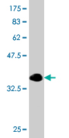 Antibody Reactive Against Recombinant Protein.Western Blot detection against Immunogen (35.86 KDa) . 