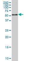ING3 monoclonal antibody (M01), clone 2E9. Western Blot analysis of ING3 expression in Hela S3 NE ( (Cat # AT2533a )