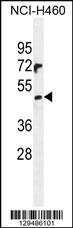PRAMEF6 Antibody (C-term) (Cat. #AP11418b) western blot analysis in NCI-H460 cell line lysates (35ug/lane).This demonstrates the PRAMEF6 antibody detected the PRAMEF6 protein (arrow).