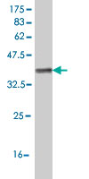Antibody Reactive Against Recombinant Protein.Western Blot detection against Immunogen (36.74 KDa) . 