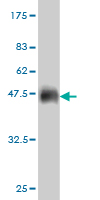 Antibody Reactive Against Recombinant Protein.Western Blot detection against Immunogen (36.63 KDa) . 