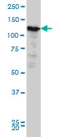NOPE monoclonal antibody (M03), clone 6E6 Western Blot analysis of NOPE expression in HeLa ( (Cat # AT3078a )