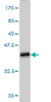 Antibody Reactive Against Recombinant Protein.Western Blot detection against Immunogen (36.74 KDa) . 