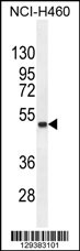 FNDC8 Antibody (Center) (Cat. #AP11395c) western blot analysis in NCI-H460 cell line lysates (35ug/lane).This demonstrates the FNDC8 antibody detected the FNDC8 protein (arrow).