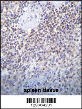 PATL2 Antibody (Center) (Cat. #AP11391c)immunohistochemistry analysis in formalin fixed and paraffin embedded human spleen tissue followed by peroxidase conjugation of the secondary antibody and DAB staining.This data demonstrates the use of PATL2 Antibody (Center) for immunohistochemistry. Clinical relevance has not been evaluated.