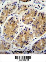 MGC24975 Antibody (C-term) (Cat. #AP11386b)immunohistochemistry analysis in formalin fixed and paraffin embedded human stomach tissue followed by peroxidase conjugation of the secondary antibody and DAB staining.This data demonstrates the use of MGC24975 Antibody (C-term) for immunohistochemistry. Clinical relevance has not been evaluated.