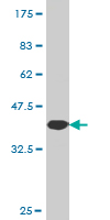 Antibody Reactive Against Recombinant Protein.Western Blot detection against Immunogen (37.62 KDa) . 