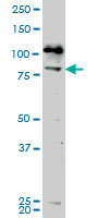 NEK5 monoclonal antibody (M02), clone 7G2. Western Blot analysis of NEK5 expression in IMR-32 ( (Cat # AT3018a )