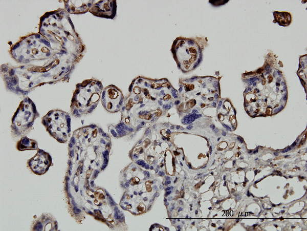Immunoperoxidase of monoclonal antibody to NEDD1 on formalin-fixed paraffin-embedded human placenta. [antibody concentration 0.75 ug/ml]