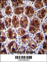 SERTAD4 Antibody (C-term) (Cat. #AP11379b)immunohistochemistry analysis in formalin fixed and paraffin embedded human stomach tissue followed by peroxidase conjugation of the secondary antibody and DAB staining.This data demonstrates the use of SERTAD4 Antibody (C-term) for immunohistochemistry. Clinical relevance has not been evaluated.