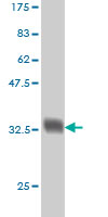 Antibody Reactive Against Recombinant Protein.Western Blot detection against Immunogen (33.99 KDa) . 
