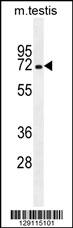 MBTD1 Antibody (C-term) (Cat. #AP11372b) western blot analysis in mouse testis tissue lysates (35ug/lane).This demonstrates the MBTD1 antibody detected the MBTD1 protein (arrow).