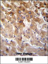 MBTD1 Antibody (C-term) (Cat. #AP11372b)immunohistochemistry analysis in formalin fixed and paraffin embedded human liver tissue followed by peroxidase conjugation of the secondary antibody and DAB staining.This data demonstrates the use of MBTD1 Antibody (C-term) for immunohistochemistry. Clinical relevance has not been evaluated.