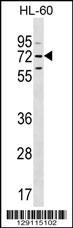 MBTD1 Antibody (C-term) (Cat. #AP11372b) western blot analysis in HL-60 cell line lysates (35ug/lane).This demonstrates the MBTD1 antibody detected the MBTD1 protein (arrow).