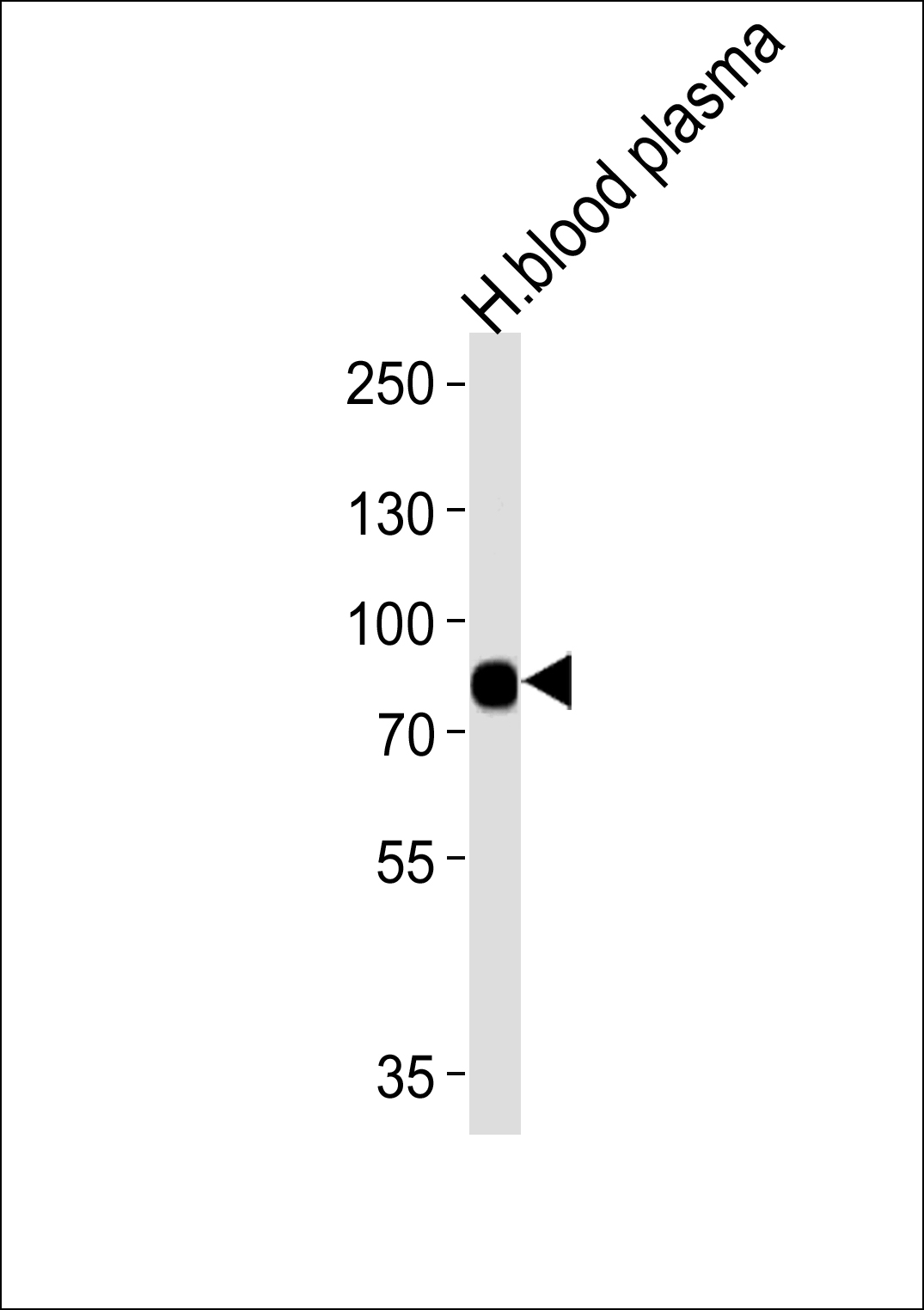 Western blot analysis of lysates from human blood plasma tissue (from left to right),using LRRC45 Antibody (C-term)(Cat. #AP11368b).AP11368b was diluted at 1:1000 at each lane. A goat anti-rabbit IgG H&L(HRP) at 1:5000 dilution was used as the secondary antibody.Lysates at 35ug per lane.