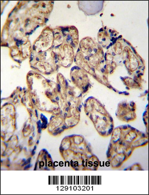 LRRC45 Antibody (C-term) (Cat. #AP11368b)immunohistochemistry analysis in formalin fixed and paraffin embedded human placenta tissue followed by peroxidase conjugation of the secondary antibody and DAB staining.This data demonstrates the use of LRRC45 Antibody (C-term) for immunohistochemistry. Clinical relevance has not been evaluated.