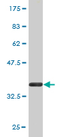 Antibody Reactive Against Recombinant Protein.Western Blot detection against Immunogen (36.63 KDa) . 