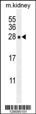 POLR3GL Antibody (Center) (Cat. #AP11367c) western blot analysis in mouse kidney tissue lysates (35ug/lane).This demonstrates the POLR3GL antibody detected the POLR3GL protein (arrow).