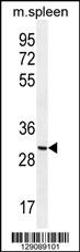 CCDC84 Antibody (N-term) (Cat. #AP11365a) western blot analysis in mouse spleen tissue lysates (35ug/lane).This demonstrates the CCDC84 antibody detected the CCDC84 protein (arrow).