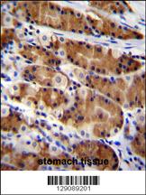 CCDC84 Antibody (N-term) (Cat. #AP11365a)immunohistochemistry analysis in formalin fixed and paraffin embedded human stomach tissue followed by peroxidase conjugation of the secondary antibody and DAB staining.This data demonstrates the use of CCDC84 Antibody (N-term) for immunohistochemistry. Clinical relevance has not been evaluated.