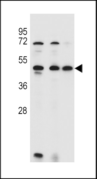 ANKRD40 Antibody (C-term) (Cat. #AP11362b) western blot analysis in 293,HL-60,MCF-7 cell line lysates (35ug/lane).This demonstrates the ANKRD40 antibody detected the ANKRD40 protein (arrow).