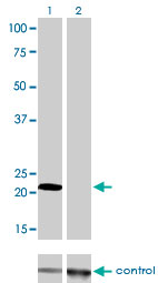 Western blot analysis of MYL1 over-expressed 293 cell line, cotransfected with MYL1 Validated Chimera RNAi ( (Cat # AT2951a )