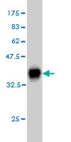 Antibody Reactive Against Recombinant Protein.Western Blot detection against Immunogen (36.63 KDa) . 