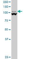 MTHFD1L monoclonal antibody (M01), clone 1E8 Western Blot analysis of MTHFD1L expression in PC-12 ( (Cat # AT2927a )
