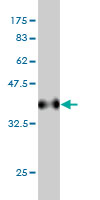 Antibody Reactive Against Recombinant Protein.Western Blot detection against Immunogen (36.74 KDa) . 
