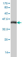 Antibody Reactive Against Recombinant Protein.Western Blot detection against Immunogen (36.74 KDa) . 