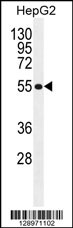 MFS10 Antibody (Center) (Cat. #AP11346c) western blot analysis in HepG2 cell line lysates (35ug/lane).This demonstrates the MFS10 antibody detected the MFS10 protein (arrow).