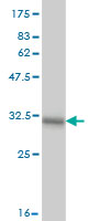 Antibody Reactive Against Recombinant Protein.Western Blot detection against Immunogen (31.13 KDa) . 