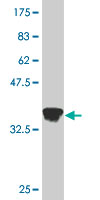 Antibody Reactive Against Recombinant Protein.Western Blot detection against Immunogen (35.53 KDa) . 