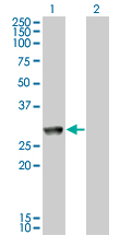 Western Blot analysis of MGC40579 expression in transfected 293T cell line by MGC40579 monoclonal antibody (M11), clone 2C11.Lane 1: MGC40579 transfected lysate(33.9 KDa).Lane 2: Non-transfected lysate.