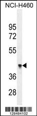 FX4L1 Antibody (N-term) (Cat. #AP11337a) western blot analysis in NCI-H460 cell line lysates (35ug/lane).This demonstrates the FX4L1 antibody detected the FX4L1 protein (arrow).