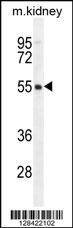 FBXO47 Antibody (N-term) (Cat. #AP11336a) western blot analysis in mouse kidney tissue lysates (35ug/lane).This demonstrates the FBXO47 antibody detected the FBXO47 protein (arrow).