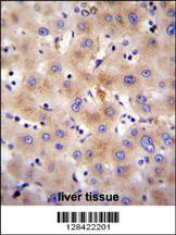FBXO47 Antibody (N-term) (Cat. #AP11336a)immunohistochemistry analysis in formalin fixed and paraffin embedded human liver tissue followed by peroxidase conjugation of the secondary antibody and DAB staining.This data demonstrates the use of FBXO47 Antibody (N-term) for immunohistochemistry. Clinical relevance has not been evaluated.