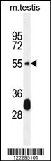 KT33A Antibody (N-term) (Cat. #AP11333a) western blot analysis in mouse testis tissue lysates (35ug/lane).This demonstrates the KT33A antibody detected the KT33A protein (arrow).