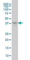 MEF2B monoclonal antibody (M10), clone 1D8 Western Blot analysis of MEF2B expression in MCF-7 ( Cat # L046V1 ).