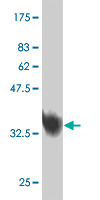 Antibody Reactive Against Recombinant Protein.Western Blot detection against Immunogen (40.15 KDa) . 