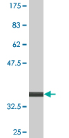 Antibody Reactive Against Recombinant Protein.Western Blot detection against Immunogen (34.32 KDa) . 