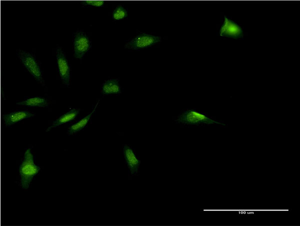 Immunofluorescence of monoclonal antibody to MDFI on HeLa cell . [antibody concentration 10 ug/ml]