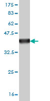 Antibody Reactive Against Recombinant Protein.Western Blot detection against Immunogen (36.3 KDa) . 