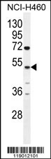 CPA6 Antibody (Center) (Cat. #AP11327c) western blot analysis in NCI-H460 cell line lysates (35ug/lane).This demonstrates the CPA6 antibody detected the CPA6 protein (arrow).