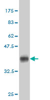 Antibody Reactive Against Recombinant Protein.Western Blot detection against Immunogen (36.63 KDa) . 