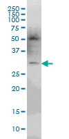 pp9099 monoclonal antibody (M03), clone 3D9 Western Blot analysis of pp9099 expression in Jurkat ( (Cat # AT3390a )